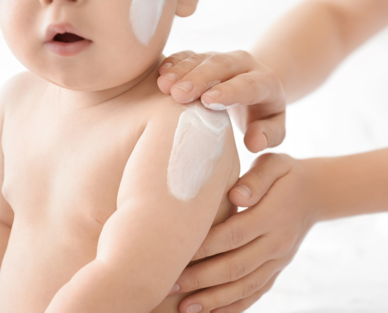 Eczema In Infants Eczema Foundation